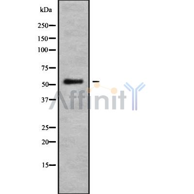 GAS8 Antibody - Western blot analysis GAS8 using HepG2 whole cell lysates.