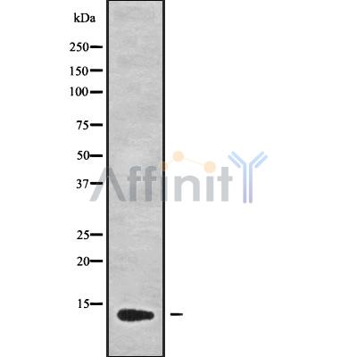 GUCA2B Antibody - Western blot analysis GUCA2B using K562 whole cell lysates.