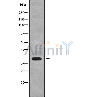 HLA-DQB2 Antibody - Western blot analysis of HLA-DQB2 using HuvEc whole cell lysates.