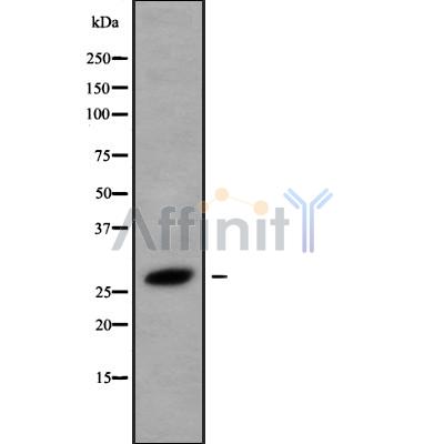 HOXB8 Antibody - Western blot analysis of HOXB8 using LOVO whole cell lysates.