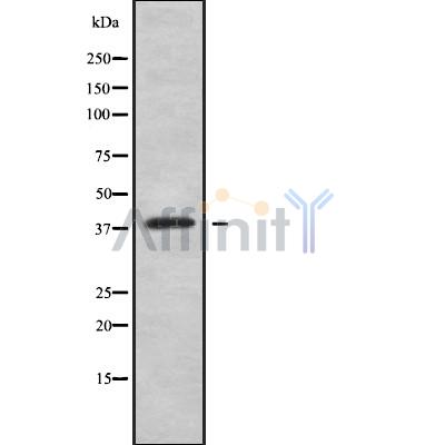 HOXC10 Antibody - Western blot analysis of HOXC10 using Jurkat whole cell lysates.