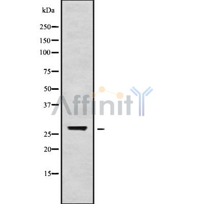 TGIF2LX Antibody - Western blot analysis of TGIF2LX using HepG2 whole cell lysates.