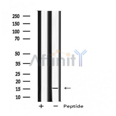 MED9 Antibody - Western blot analysis of MED9 using Jurkat whole cell lysates.