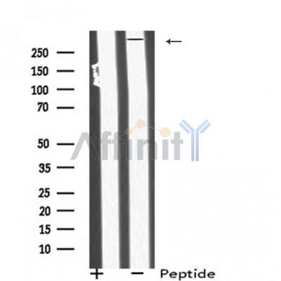 MIA3 Antibody - Western blot analysis of MIA3 using Jurkat whole cell lysates.