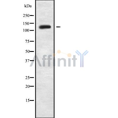 MYBPC2 Antibody - Western blot analysis of MYBPC2 using mouse liver lysates.