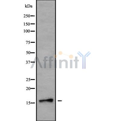 NDUFB7 Antibody - Western blot analysis NDUFB7 using HuvEc whole cell lysates.