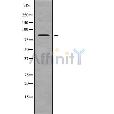 NPHP1 Antibody - Western blot analysis NPHP1 using HepG2 whole cell lysates.