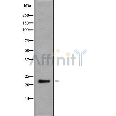 NRSN2 Antibody - Western blot analysis NRSN2 using K562 whole cell lysates.