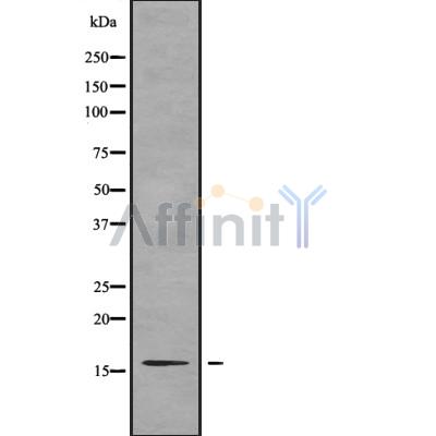 TNP2 Antibody - Western blot analysis of TNP2 using A549 whole cell lysates.