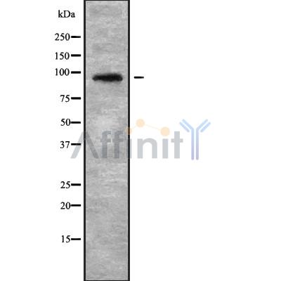 NOL14 Antibody - Western blot analysis NOL14 using Jurkat whole cell lysates.
