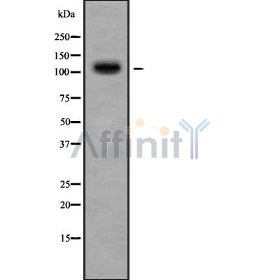 PLD2 Antibody - Western blot analysis of PLD2 using HuvEc whole cell lysates.