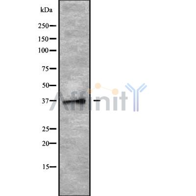 PLSCR4 Antibody - Western blot analysis of PLSCR4 using MCF7 whole cell lysates.