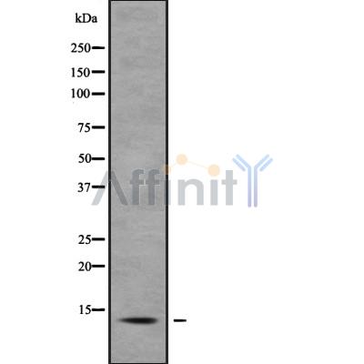 S100A7 Antibody - Western blot analysis S100A7 using Jurkat whole cell lysates.