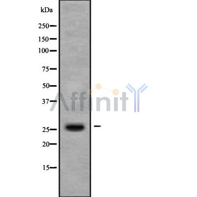 TIGA1 Antibody - Western blot analysis of TIGA1 using COLO205 whole cell lysates.