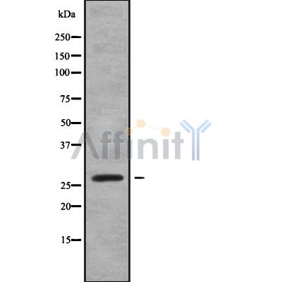 RABL2B Antibody - Western blot analysis of RABL2B using HeLa whole cell lysates.