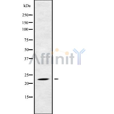 RAB17 Antibody - Western blot analysis of RAB17 using HuvEc whole cell lysates.