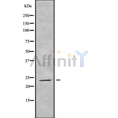 RAB19 Antibody - Western blot analysis of RAB19 using HT29 whole cell lysates.