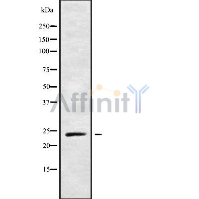 RAB21 Antibody - Western blot analysis of RAB21 using LOVO whole cell lysates.