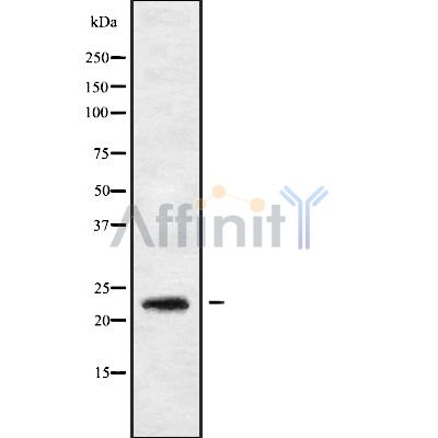 RAB30 Antibody - Western blot analysis of RAB30 using K562 whole cell lysates.