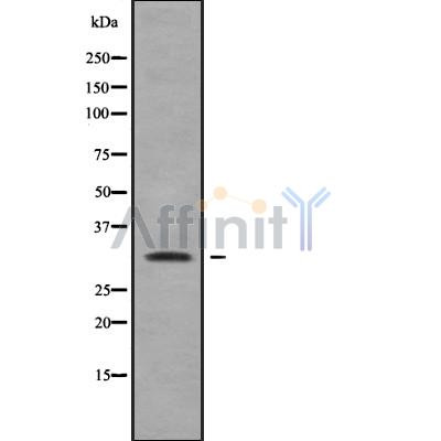 RAB40A Antibody - Western blot analysis of RAB40A using Jurkat whole cell lysates.
