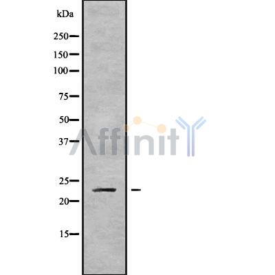 RAB43 Antibody - Western blot analysis of RAB43 using K562 whole cell lysates.
