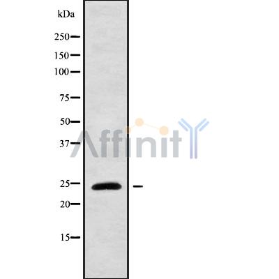 RGS17 Antibody - Western blot analysis of RGS17 using HeLa whole cell lysates.