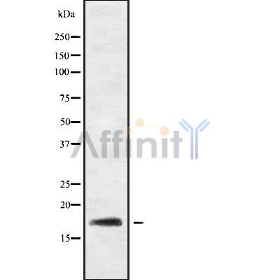 RGS21 Antibody - Western blot analysis of RGS21 using HeLa whole cell lysates.