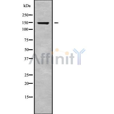 RGS22 Antibody - Western blot analysis of RGS22 using HeLa whole cell lysates.
