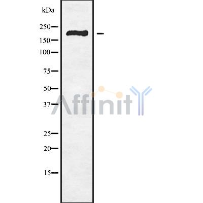 RBBP6 Antibody - Western blot analysis of RBBP6 using HuvEc whole cell lysates.