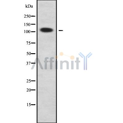 RHG30 Antibody - Western blot analysis of RHG30 using COLO205 whole cell lysates.