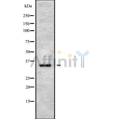 PIM2 Antibody - Western blot analysis of PIM2 using MCF7 whole cell lysates.