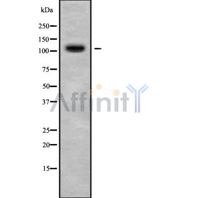 PPP4R1 Antibody - Western blot analysis of PPP4R1 using K562 whole cell lysates.