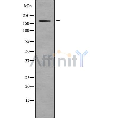 SHANK3 Antibody - Western blot analysis SHANK3 using Jurkat whole cell lysates.