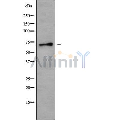 SLC6A18 Antibody - Western blot analysis SLC6A18 using HepG2 whole cell lysates.