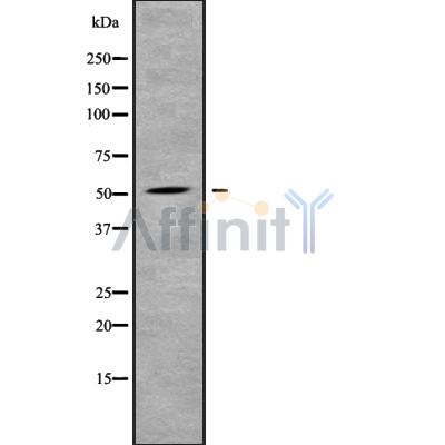 GLUT2 Antibody - Western blot analysis SLC2A2 using Jurkat whole cell lysates.
