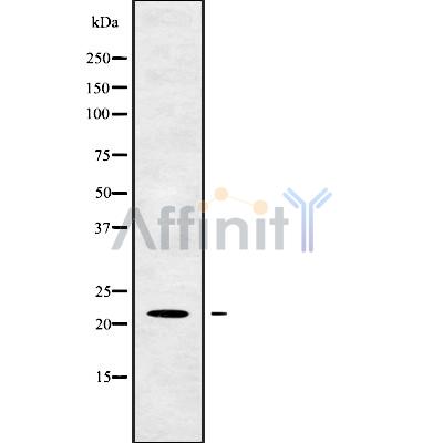 TM2D1 Antibody - Western blot analysis of TM2D1 using K562 whole cell lysates.