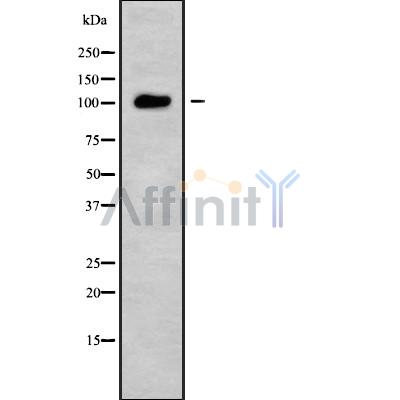 USP26 Antibody - Western blot analysis USP26 using HuvEc whole cell lysates.
