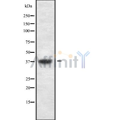 USP3 Antibody - Western blot analysis USP3 using HeLa whole cell lysates.