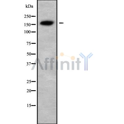 USP6 Antibody - Western blot analysis USP6 using HeLa whole cell lysates.