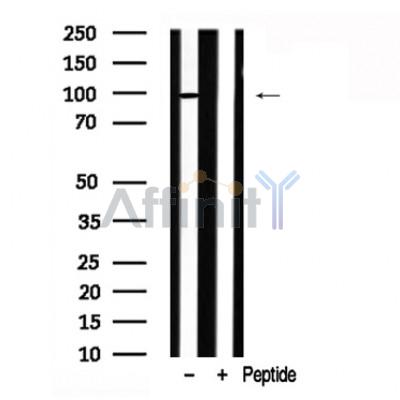 STAT1 Antibody - Western blot analysis of STAT1 in lysates of Jurkat , using STAT1 Antibody(AF7801).