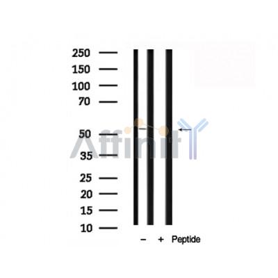 WASP Antibody - Western blot analysis of WASP in lysates of HepG2, using WASP Antibody(AF7804).