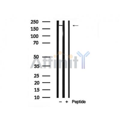Tuberin/TSC2 Antibody - Western blot analysis of Tuberin/TSC2 in lysates of 293, using Tuberin/TSC2 Antibody(AF7812).