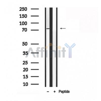LIMK2 Antibody - Western blot analysis of LIMK2 in lysates of NIH-3T3  , using LIMK2 Antibody(AF7824).
