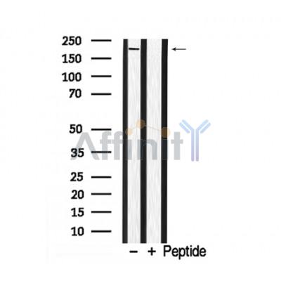 NCoA2 Antibody - Western blot analysis of NCoA2 in lysates of HeLa  , using NCoA2 Antibody(AF7894).