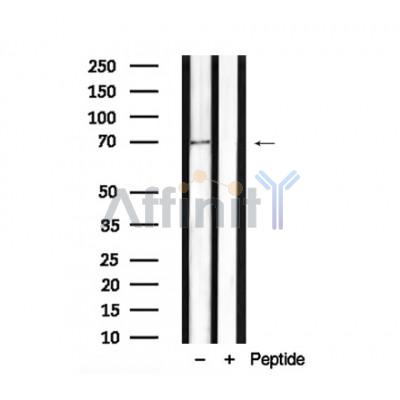 Myt1 Antibody - Western blot analysis of Myt1 in lysates of HeLa , using Myt1 Antibody(AF7935).