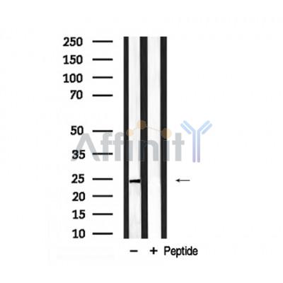 LIN28A Antibody - Western blot analysis of LIN28A in lysates of Neuro-2a , using LIN28A Antibody(AF7938).