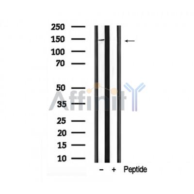 PERK Antibody - Western blot analysis of perk in lysates of HepG2 , using perk Antibody(AF7941).