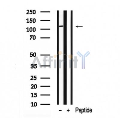 KIF5B Antibody - Western blot analysis of KIF5B in lysates of HepG2 , using KIF5B Antibody(AF7947).