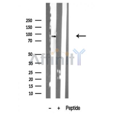 Centaurin beta-1 Antibody - Western blot analysis of extracts from Mouse lung tissue sample,using Centaurin 1 Antibody(DF10313).
