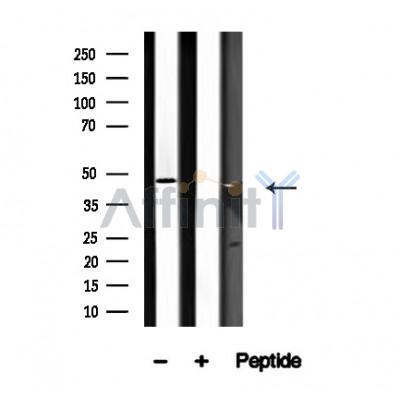 DEPTOR Antibody - Western blot analysis of DEPTOR in lysates of MCF7, using DEPTOR Antibody(AF4613).
